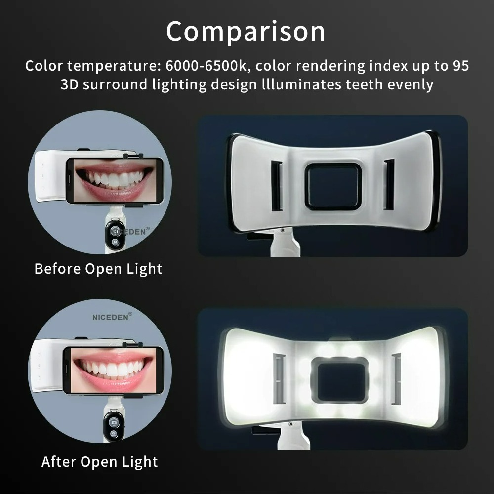 Dental Photography Light Phone - Photography Lighting Accessories ulasan dan harga